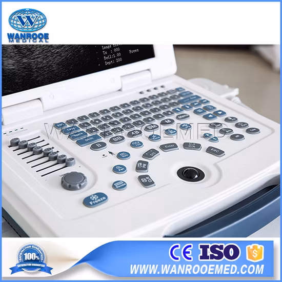 Digitaler tragbarer Ultraschall-Diagnosegeräte-Ultraschallscanner